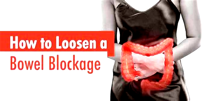 How to loosen a bowel blockage at home?